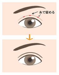 施術の様子